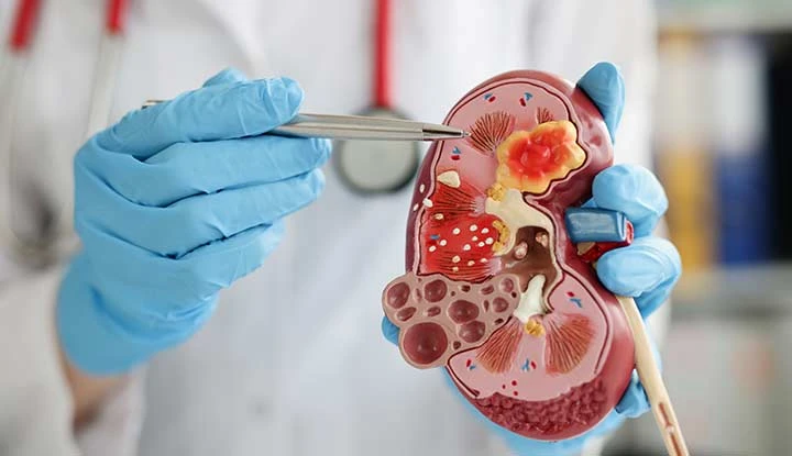 Dialysis & Nephrology